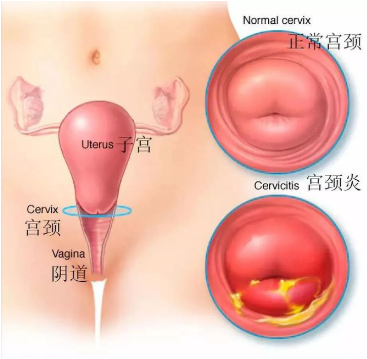 自从有了性生活，我的妇科病从来没有这么好过！我老公没把这两件事做好，就